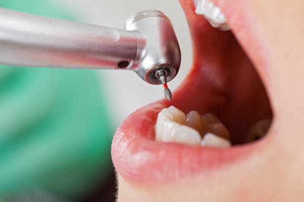 Best Urgent Tooth Repair  in Eufaula, AL